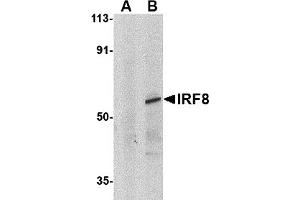 Western Blotting (WB) image for anti-Interferon Regulatory Factor 8 (IRF8) (C-Term) antibody (ABIN1030453) (IRF8 Antikörper  (C-Term))