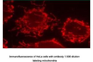Image no. 1 for anti-Inner Membrane Protein, Mitochondrial (IMMT) antibody (ABIN363364) (IMMT Antikörper)