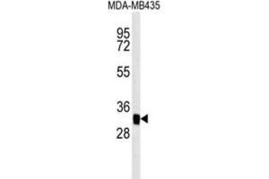 Western Blotting (WB) image for anti-Mitochondrial Carrier 2 (MTCH2) antibody (ABIN3002367) (MTCH2 Antikörper)