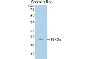 Detection of Recombinant CYP1B1, Human using Polyclonal Antibody to Cytochrome P450 1B1 (CYP1B1) (CYP1B1 Antikörper  (AA 374-516))