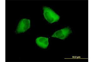 Immunofluorescence (IF) image for anti-Programmed Cell Death 6 Interacting Protein (PDCD6IP) (AA 1-868) antibody (ABIN523392)