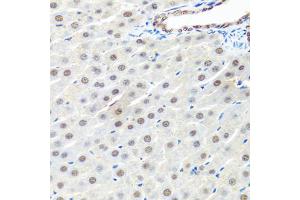 Immunohistochemistry of paraffin-embedded rat liver using PRPF19 antibody (ABIN6293423) at dilution of 1:100 (40x lens). (PRP19 Antikörper)