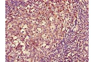 Immunohistochemistry (IHC) image for anti-Major Histocompatibility Complex, Class II, DQ alpha 1 (HLA-DQA1) (AA 24-213) antibody (Biotin) (ABIN7155590)