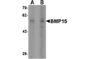 Western blot analysis of BMP15 in 3T3 cell lysate with BMP15 Antibody  at (A) 1 and (B) 2 µg/ml (BMP15 Antikörper  (N-Term))