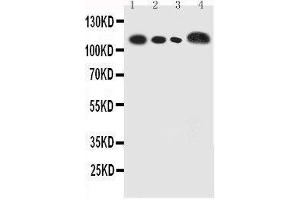 Anti-human CEACAM5 antibody, Western blotting Lane 1: Recombinant Human CEA Protein 5ng Lane 2: Recombinant Human CEA Protein 2 (CEACAM5 Antikörper  (full length))