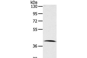 Western Blot analysis of Human lymphoma tissue using CDK10 Polyclonal Antibody at dilution of 1:100 (CDK10 Antikörper)