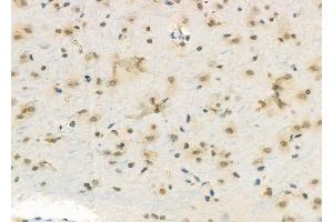 ABIN6263269 and ABIN6272345 at 1/100 staining Rat brain tissue by IHC-P. (DUSP4 Antikörper  (Internal Region))