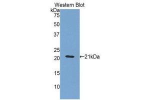 Western Blotting (WB) image for anti-Orosomucoid 1 (ORM1) (AA 20-186) antibody (ABIN3207789) (ORM1 Antikörper  (AA 20-186))