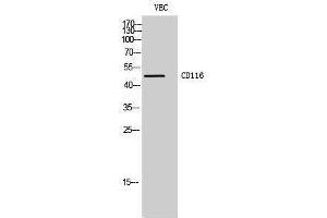 Western Blotting (WB) image for anti-Colony Stimulating Factor 2 Receptor, Alpha, Low-Affinity (Granulocyte-Macrophage) (CSF2RA) (Internal Region) antibody (ABIN3183730) (CSF2RA Antikörper  (Internal Region))