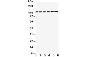 Western blot testing of CAR antibody and rat samples 1: pancreas;  2: brain;  3: heart; and human samples 4: HeLa;  5: 293T;  6: COLO320 cell lysate. (Coxsackie Adenovirus Receptor Antikörper  (C-Term))