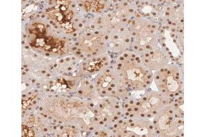 ABIN6267376 at 1/200 staining human kidney tissue sections by IHC-P. (Glycogen Synthase 1 Antikörper  (pSer645))