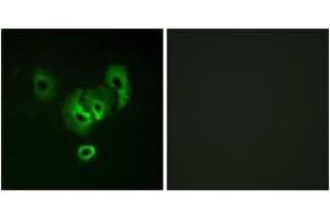 Immunofluorescence analysis of A549 cells, using STEA2 Antibody. (STEAP2 Antikörper  (AA 431-480))