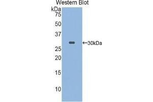 Western blot analysis of the recombinant protein. (FKBP10 Antikörper  (AA 316-573))