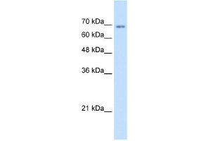 WB Suggested Anti-TM9SF1 Antibody Titration:  1. (TM9SF1 Antikörper  (N-Term))