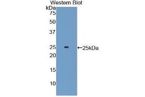 Western Blotting (WB) image for anti-Androgen Receptor (AR) (AA 491-679) antibody (ABIN1174429) (Androgen Receptor Antikörper  (AA 491-679))