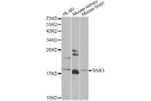 Western blot analysis of extracts of various cell lines, using SNX3 antibody. (Sorting Nexin 3 Antikörper)