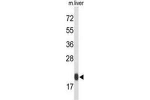Western blot analysis of Glutathione peroxidase 1 / GPX1 (arrow) in mouse liver tissue lysates (35ug/lane) using Glutathione peroxidase 1 / GPX1  Antibody (C-term).