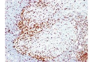 Formalin-fixed, paraffin-embedded human Tonsil stained with ZAP70 Mouse Monoclonal Antibody (2F3. (ZAP70 Antikörper  (AA 1-254))