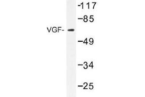 Image no. 1 for anti-VGF Nerve Growth Factor Inducible (VGF) antibody (ABIN317924) (VGF Antikörper)