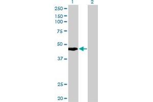 Western Blot analysis of KRTHA4 expression in transfected 293T cell line by KRTHA4 monoclonal antibody (M10), clone 3E5.