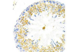 Immunohistochemistry (IHC) image for anti-TAP Binding Protein (Tapasin) (TAPBP) (AA 30-260) antibody (ABIN6148848)