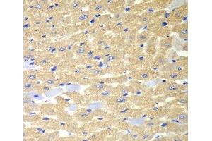 Immunohistochemistry of paraffin-embedded Mouse heart using RPH3A Polyclonal Antibody at dilution of 1:100 (40x lens). (RPH3A Antikörper)