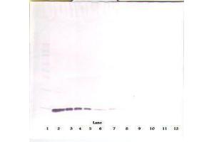 Image no. 1 for anti-Interleukin 2 (IL2) antibody (ABIN465098) (IL-2 Antikörper)