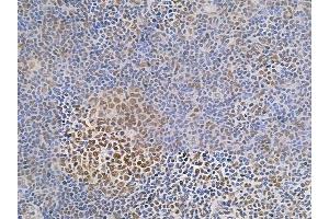 ABIN6255529 and ABIN6266456 at 1/100 staining human normal tonsil tissue by IHC-P.