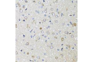 Immunohistochemistry of paraffin-embedded rat brain using B2M antibody.