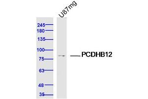 U87MG lysates probed with PCDHB12 Polyclonal Antibody, Unconjugated  at 1:300 dilution and 4˚C overnight incubation. (PCDHB12 Antikörper  (AA 121-220))