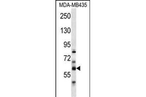 PTDSS2 Antibody (N-term) (ABIN656975 and ABIN2846159) western blot analysis in MDA-M cell line lysates (35 μg/lane). (PTDSS2 Antikörper  (N-Term))