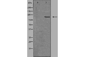 Western blot analysis of extracts from Jurkat cells, using NOX5 antibody. (NOX5 Antikörper  (C-Term))