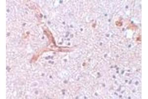 Immunohistochemistry (IHC) image for anti-Zinc Finger CCCH-Type Containing 12C (ZC3H12C) (N-Term) antibody (ABIN1031674) (ZC3H12C Antikörper  (N-Term))