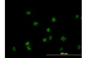 Immunofluorescence of monoclonal antibody to GATA2 on HeLa cell. (GATA2 Antikörper  (AA 1-102))