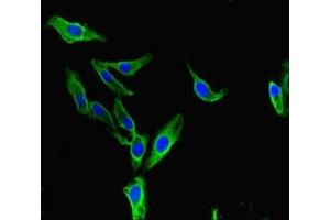 Immunofluorescent analysis of Hela cells using ABIN7145796 at dilution of 1:100 and Alexa Fluor 488-congugated AffiniPure Goat Anti-Rabbit IgG(H+L) (BAZ2A Antikörper  (AA 97-266))