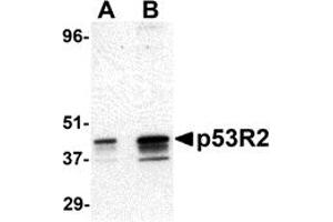 Western Blotting (WB) image for anti-Ribonucleotide Reductase M2 B (TP53 Inducible) (RRM2B) (N-Term) antibody (ABIN1031501) (RRM2B Antikörper  (N-Term))