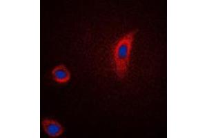 Immunofluorescent analysis of PGHS-2 staining in Jurkat cells. (PTGS2 Antikörper  (C-Term))