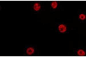 ABIN6275198 staining HepG2 by IF/ICC. (Six5 Antikörper  (C-Term))