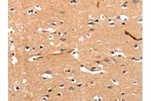 The image on the left is immunohistochemistry of paraffin-embedded Human brain tissue using ABIN7190258(CHRNA3 Antibody) at dilution 1/30, on the right is treated with synthetic peptide. (CHRNA3 Antikörper)