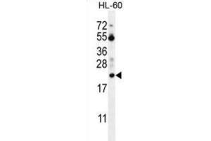 Western Blotting (WB) image for anti-Prothymosin, alpha (PTMA) antibody (ABIN2996364) (PTMA Antikörper)