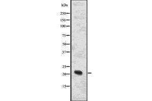Western blot analysis of NRAS using mouse liver lysates.
