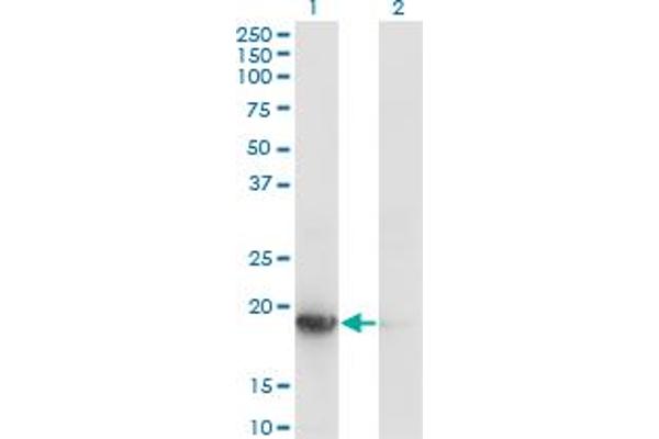 UBE2G1 anticorps  (AA 1-170)
