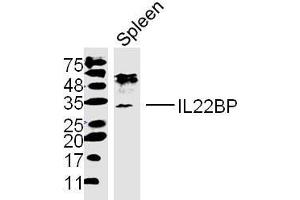 Mouse spleen lysates probed with IL22BP Polyclonal Antibody, unconjugated  at 1:300 overnight at 4°C followed by a conjugated secondary antibody at 1:10000 for 90 minutes at 37°C. (IL22RA2 Antikörper  (AA 165-263))