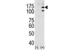 Western blot analysis of EGFR in HeLa cell lysate, either noninduced (Lane 1) or induced with EGF (2).