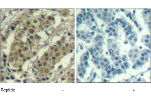 Image no. 1 for anti-V-Akt Murine Thymoma Viral Oncogene Homolog 1 (AKT1) (Thr450) antibody (ABIN319375) (AKT1 Antikörper  (Thr450))