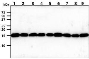 The cell lysates (40ug) were resolved by SDS-PAGE, transferred to PVDF membrane and probed with anti-human Tomm20 antibody (1:1000). (TOMM20 Antikörper)