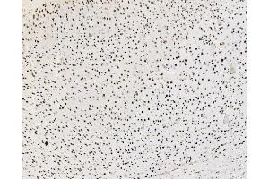IHC analysis of JUNB using anti-JUNB antibody (ABIN7603223). (JunB Antikörper  (N-Term))