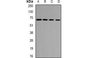 Western blot analysis of ETFDH expression in mouse heart (A), mouse kidney (B), rat liver (C), rat heart (D) whole cell lysates. (ETFDH Antikörper)