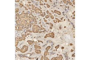 IHC analysis of TST using anti-TST antibody (ABIN7599105).