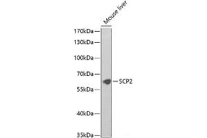 Western blot analysis of extracts of Mouse liver using SCP2 Polyclonal Antibody at dilution of 1:1000. (SCP2 Antikörper)